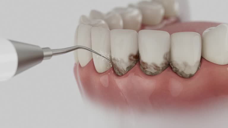 Trusted Teeth Cleaning And Checkup service in Caledonia, MS - Dentist Open Now
